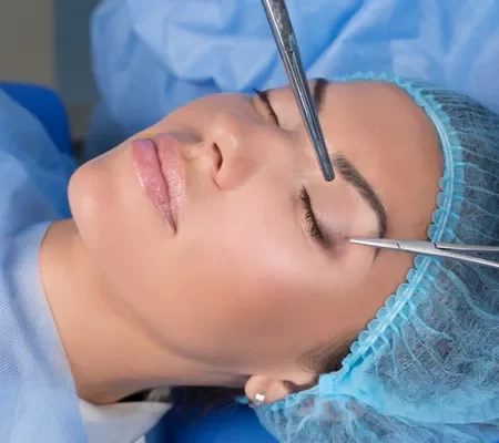 Blefaroplastia (pálpebras)