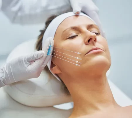 Lifting facial (ritidoplastia)