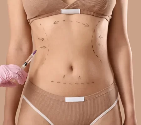 Lipoescultura com enxerto de gordura