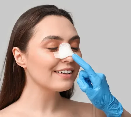 Rinoplastia